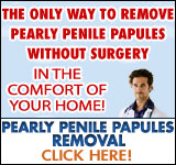 Pearly Penile Papules Removal